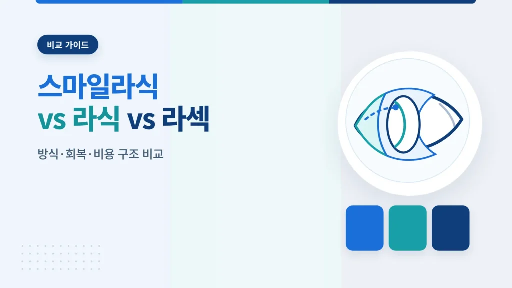 스마일라식 라식 라섹 차이 가이드 썸네일